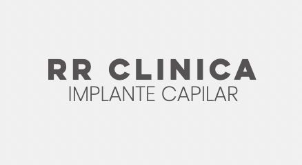 Implante Capilar Chile